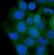 Immunofluorescent staining of FFPE human A431 cells with AHSA1 antibody (green) and DAPI nuclear stain (blue). HIER: steam section in pH6 citrate buffer for 20 min.