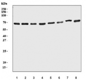 Western blot testing of human 1) MCF-7, 2) HepG2, 3) HeLa, 4) 293T, 5) K562, 6) Daudi, 7) HL60 and 8) MOLT4 cell lysate with PRMT3 antibody. Predicted molecular weight: 55-60 kDa.