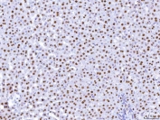 IHC staining of FFPE rat liver tissue with HNF4A antibody. HIER: boil tissue sections in pH8 EDTA for 20 min and allow to cool before testing.