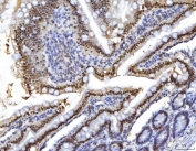 IHC staining of FFPE rat colon tissue with HNF4A antibody. HIER: boil tissue sections in pH8 EDTA for 20 min and allow to cool before testing.