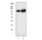 Western blot testing of human 1) Ramos and 2) Raji cell lysate with ICAM1 antibody. Predicted molecular weight: ~58 kDa (unmodified), 75-115 kDa (glycosylated).