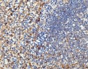 IHC staining of FFPE human spleen tissue with Intercellular adhesion molecule 1 antibody. HIER: boil tissue sections in pH8 EDTA for 20 min and allow to cool before testing.