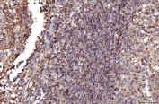 IHC staining of FFPE human tonsil tissue with RAB5A/B/C antibody. HIER: boil tissue sections in pH8 EDTA for 20 min and allow to cool before testing.