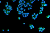 Immunofluorescent staining of FFPE human MCF7 cells with RAB5A/B/C antibody (green) and DAPI nuclear stain (blue). HIER: steam section in pH6 citrate buffer for 20 min.