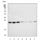 Western blot testing of 1) human U-87 MG, 2) human MCF7, 3) human U-251, 4) human HL60, 5) rat kidney, 6) rat testis and 7) mouse kidney tissue lysate with RAB5A/B/C antibody. Predicted molecular weight: 23-25 kDa.