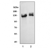 Western blot testing of human 1) U-87 MG and 2) A431 cell lysate with Integrin alpha 3 antibody. Expected molecular weight: 119-150 kDa depending on glycosylation level.