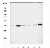 Western blot testing of human 1) K562, 2) MCF7, 3) HeLa, 4) Jurkat, 5) A431 and 6) HaCaT cell lysate with COX2 antibody. Predicted molecular weight ~25 kDa.