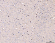IHC staining of FFPE mouse brain tissue with COX2 antibody. HIER: boil tissue sections in pH8 EDTA for 20 min and allow to cool before testing.
