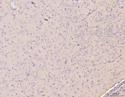 IHC staining of FFPE rat brain tissue with COX2 antibody. HIER: boil tissue sections in pH8 EDTA for 20 min and allow to cool before testing.