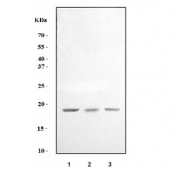 Western blot testing of human 1) HeLa, 2) HepG2 and 3) RT4 cell lysate with MT-ND6 antibody. Predicted molecular weight ~19 kDa.