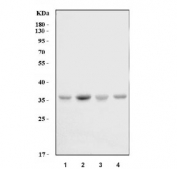 Western blot testing of human 1) HepG2, 2) K562, 3) A549 and 4) MCF7 cell lysate with MYD88 antibody. Predicted molecular weight: 33 kDa