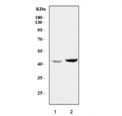 Western blot testing of human 1) Caco-2 and 2) RT4 cell lysate with Transcription factor Sp6 antibody. Predicted molecular weight ~40 kDa.