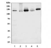 Western blot testing of 1) human placenta, 2) human U-87 MG, 3) human PC-3, 4) human MCF7 and 5) rat stomach lysate with NRP1 antibody. Expected molecular weight: 102-130 kDa.