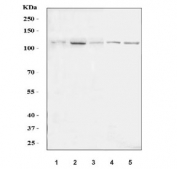 Western blot testing of 1) human HeLa, 2) human HepG2, 3) human MOLT-4, 4) rat liver and 5) mouse liver tissue lysate with PALB2 antibody. Predicted molecular weight ~131 kDa.