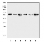 Western blot testing of human 1) placenta, 2) A549, 3) SW620, 4) HEK293, 5) K562 and 6) Raji cell lysate with ERp57 antibody. Predicted molecular weight: ~57-60 kDa.