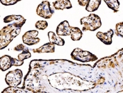IHC staining of FFPE human placental tissue with PDIA6 antibody. HIER: boil tissue sections in pH8 EDTA for 20 min and allow to cool before testing.