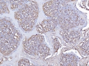 IHC staining of FFPE human tonsil tissue with PLEK antibody. HIER: boil tissue sections in pH8 EDTA for 20 min and allow to cool before testing.