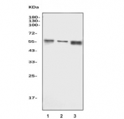 Western blot testing of human 1) Jurkat, 2) Ramos and 3) HL60 cell lysate with TOX antibody. Predicted molecular weight ~57 kDa.