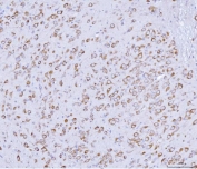 IHC staining of FFPE rat brain tissue with PACT antibody. HIER: boil tissue sections in pH8 EDTA for 20 min and allow to cool before testing.
