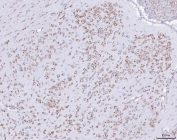 IHC staining of FFPE mouse brain tissue with PACT antibody. HIER: boil tissue sections in pH8 EDTA for 20 min and allow to cool before testing.