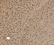 IHC staining of FFPE mouse brain tissue with Proteasome 20S beta 7 antibody. HIER: boil tissue sections in pH8 EDTA for 20 min and allow to cool before testing.
