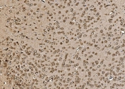 IHC staining of FFPE rat brain tissue with Proteasome 20S beta 7 antibody. HIER: boil tissue sections in pH8 EDTA for 20 min and allow to cool before testing.