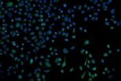 Immunofluorescent staining of FFPE human HeLa cells with Proteasome 20S beta 7 antibody (green) and DAPI nuclear stain (blue). HIER: steam section in pH6 citrate buffer for 20 min.