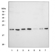 Western blot testing of 1) human HeLa, 2) human Jurkat, 3) human COLO-320, 4) human K562, 5) rat liver, 6) rat RH35 and 7) mouse HEPA1-6 cell lysate with Prostaglandin E synthase 3 antibody. Predicted molecular weight ~23 kDa.
