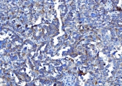 IHC staining of FFPE human ovarian tissue with Poliovirus Receptor antibody. HIER: boil tissue sections in pH8 EDTA for 20 min and allow to cool before testing.