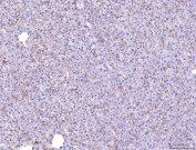IHC staining of FFPE mouse liver tissue with Poliovirus Receptor antibody. HIER: boil tissue sections in pH8 EDTA for 20 min and allow to cool before testing.