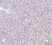 IHC staining of FFPE mouse liver tissue with Poliovirus Receptor antibody. HIER: boil tissue sections in pH8 EDTA for 20 min and allow to cool before testing.