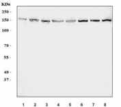 Western blot testing of human 1) Jurkat, 2) MCF7, 3) HeLa, 4) K562, 5) A549, 6) Caco-2, 7) Daudi and 8) SH-SY5Y cell lysate with RAD50 antibody. Predicted molecular weight 138-154 kDa (multiple isoforms).