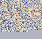 IHC staining of FFPE human testis tissue with RAD50 antibody, HRP-secondary and DAB substrate. HIER: boil tissue sections in pH8 EDTA for 20 min and allow to cool before testing.