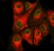 Immunofluorescent staining of FFPE human A549 cells with RAD50 antibody (green) and Alpha Tubulin mAb (red). HIER: steam section in pH6 citrate buffer for 20 min.