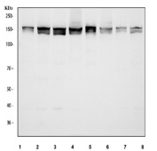 Western blot testing of 1) human Jurkat, 2) human MCF7, 3) human HeLa, 4) human K562, 5) rat thymus, 6) rat C6, 7) mouse thymus and 8) NIH 3T3 cell lysate with RAD50 antibody. Predicted molecular weight 138-154 kDa (multiple isoforms).