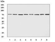Western blot testing of human 1) SH-SY5Y, 2) 293T, 3) HeLa, 4) A431, 5) HaCaT, 6) MCF7, 7) HL60 and 8) U-251 cell lysate with Ran GTPase-activating protein 1 antibody. Predicted molecular weight 64-70 kDa.
