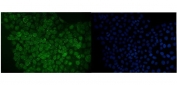 Immunofluorescent staining of FFPE human A431 cells with Ran GTPase-activating protein 1 antibody (green) and DAPI nuclear stain (blue). HIER: steam section in pH6 citrate buffer for 20 min.