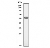 Western blot testing of human A549 cell lysate with Aldehyde dehydrogenase 3 antibody. Predicted molecular weight: ~51 kDa.
