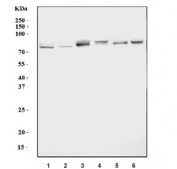 Western blot testing of 1) human HepG2, 2) human MCF7, 3) rat brain, 4) rat testis, 5) mouse brain and 6) mouse testis lysate with Solo antibody. Predicted molecular weight ~79 kDa.