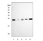 Western blot testing of 1) human HepG2, 2) human HCCT, 3) human HCCP, 4) mouse liver and 5) mouse heart tissue lysate with Superoxide Dismutase 2 antibody. Predicted molecular weight ~25 kDa.