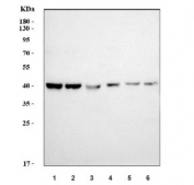 Western blot testing of 1) human T-47D, 2) HL60, 3) A549, 4) HepG2, 5) rat brain and 6) mouse brain tissue lysate with Poly(rC)-binding protein 2 antibody. Predicted molecular weight ~39 kDa.