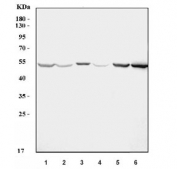 Western blot testing of 1) human HepG2, 2) Caco-2, 3) U-2 OS, 4) A549, 5) rat liver and 6) mouse liver tissue lysate with Aquaporin 11 antibody. Predicted molecular weight 26~30 kDa.