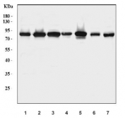 Western blot testing of 1) human 293T, 2) human HepG2, 3) human LNCaP, 4) rat brain, 5) rat C6, 6) mouse brain and 7) mouse Neuro-2a cell lysate with TANK-binding kinase 1 antibody. Predicted molecular weight: ~84 kDa.