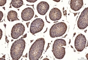 IHC staining of FFPE mouse testis tissue with TANK-binding kinase 1 antibody. HIER: boil tissue sections in pH8 EDTA for 20 min and allow to cool before testing.