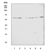 Western blot testing of 1) human 293T, 2) human HeLa, 3) human Jurkat, 4) human MCF7, 5) rat PC-12 and 6) mouse NIH 3T3 cell lysate with CENPI antibody. Predicted molecular weight: ~87 kDa (isoform 1) and ~60 kDa (isoform 2).
