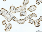 IHC staining of FFPE human placental tissue with p53 binding protein 1 antibody. HIER: boil tissue sections in pH8 EDTA for 20 min and allow to cool before testing.