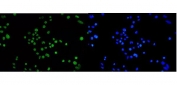 Immunofluorescent staining of FFPE human SiHa cells with TPR antibody (green) and DAPI nuclear stain (blue). HIER: steam section in pH6 citrate buffer for 20 min.