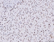 IHC staining of FFPE mouse brain tissue with TPR antibody. HIER: boil tissue sections in pH8 EDTA for 20 min and allow to cool before testing.