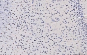 IHC staining of FFPE rat brain tissue with TPR antibody. HIER: boil tissue sections in pH8 EDTA for 20 min and allow to cool before testing.