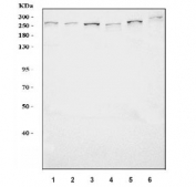 Western blot testing of human 1) K562, 2) HL60, 3) HEL, 4) HeLa, 5) U-251 and 6) SiHa cell lysate with TPR antibody. Predicted molecular weight ~267 kDa.